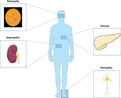 Diabetic complications and prospective immunotherapy